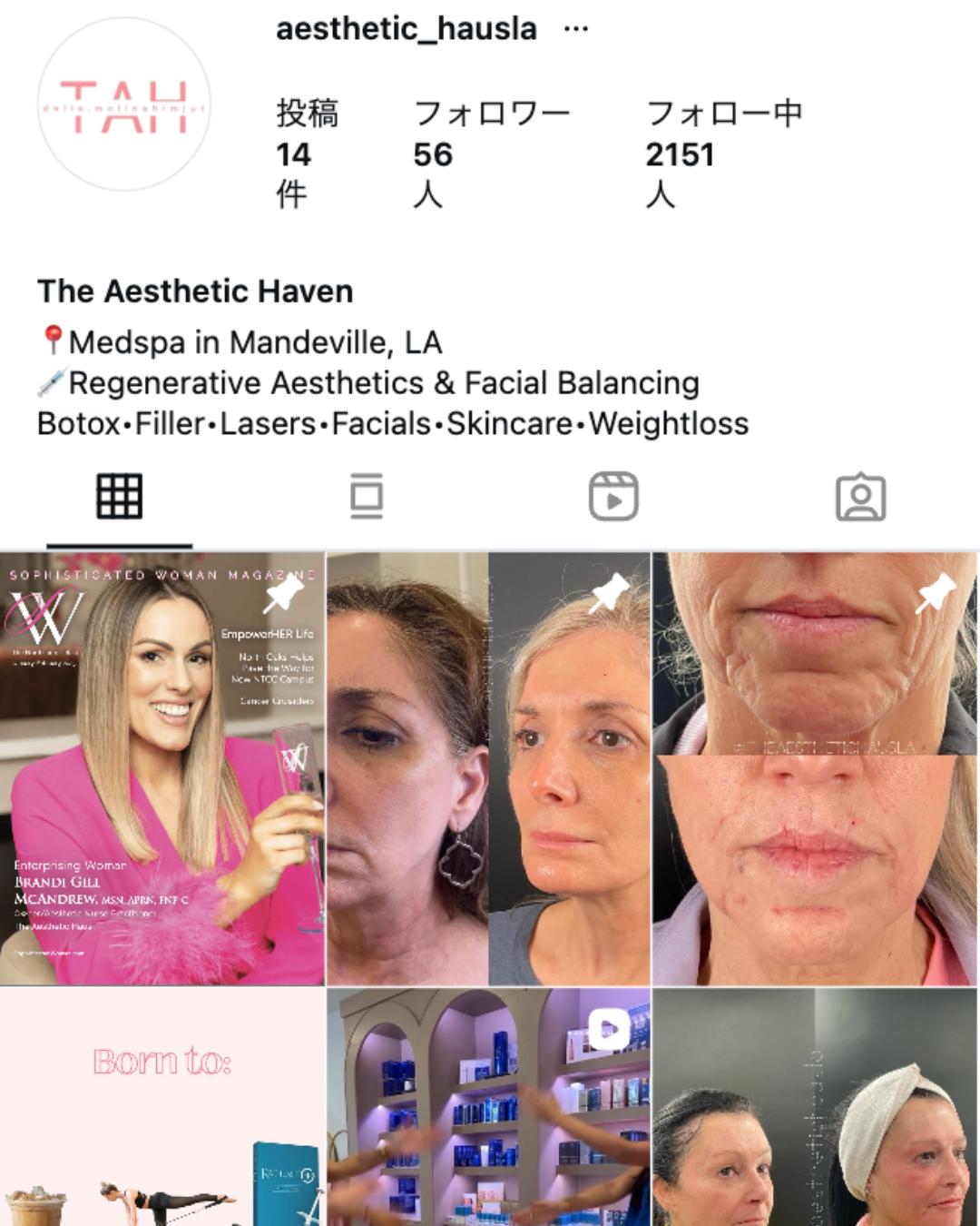 海外フォロワー例2